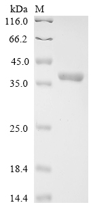 SDS-PAGE