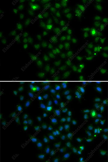Иммунофлуоресценция, LMO4, клетки MCF-7