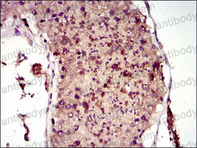 Валидация AntibodySystem RHJ56805