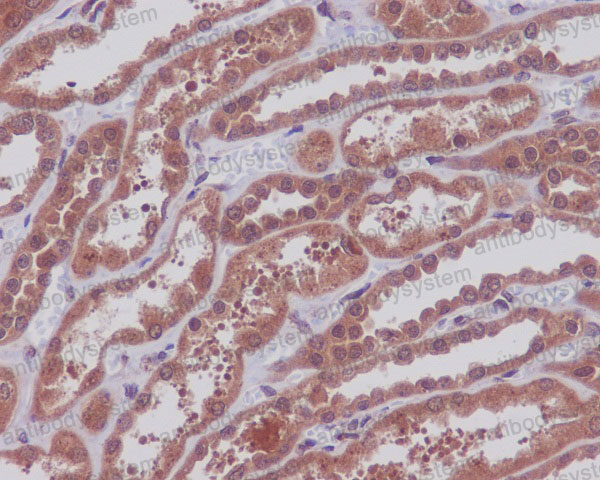 Валидация AntibodySystem RHF95503