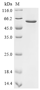 SDS-PAGE