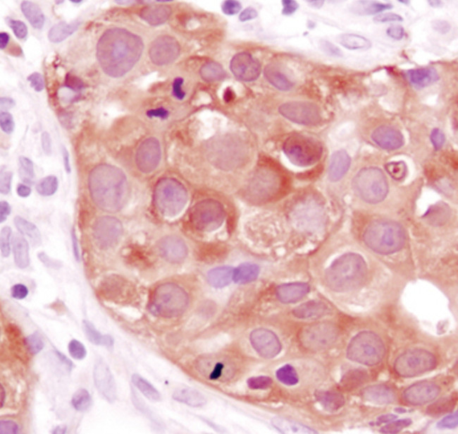 Валидация AssayVector ARM2303(3968)