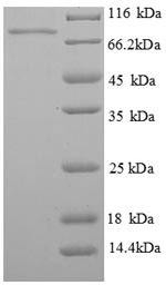 SDS-PAGE