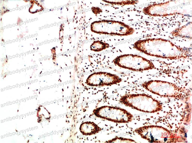 Валидация AntibodySystem RHE45607 (2172)