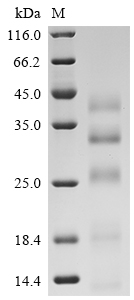 SDS-PAGE