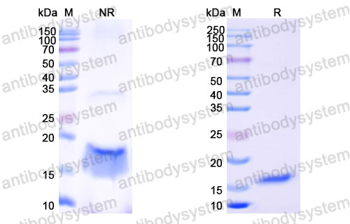 Валидация SDS-PAGE - AntibodySystem RHC15801