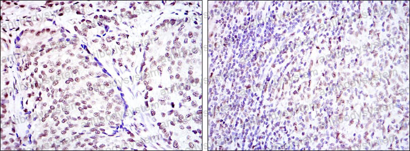 Валидация AntibodySystem RHD15905