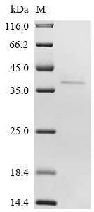 SDS-PAGE