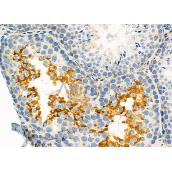 Валидация Affinity DF7277 - 18945