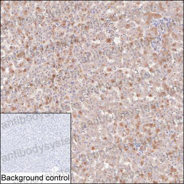 Валидация AntibodySystem RHC01202