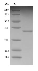 SDS-PAGE