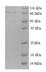 SDS-PAGE