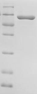 SDS-PAGE
