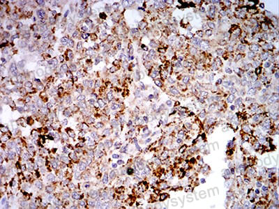 Валидация AntibodySystem RHJ65504