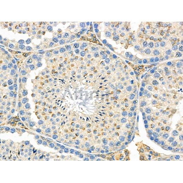 Валидация Affinity DF6458 - 17844