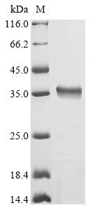 SDS-PAGE