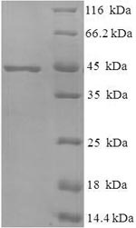 SDS-PAGE