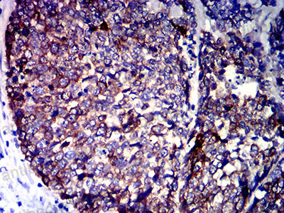 Валидация AntibodySystem RHE23502