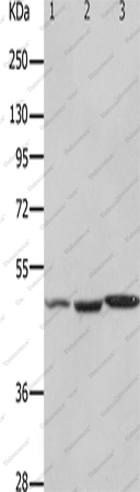 Вестерн-блоттинг, HCRTR2, ткани почки, мозга и сердца мыши