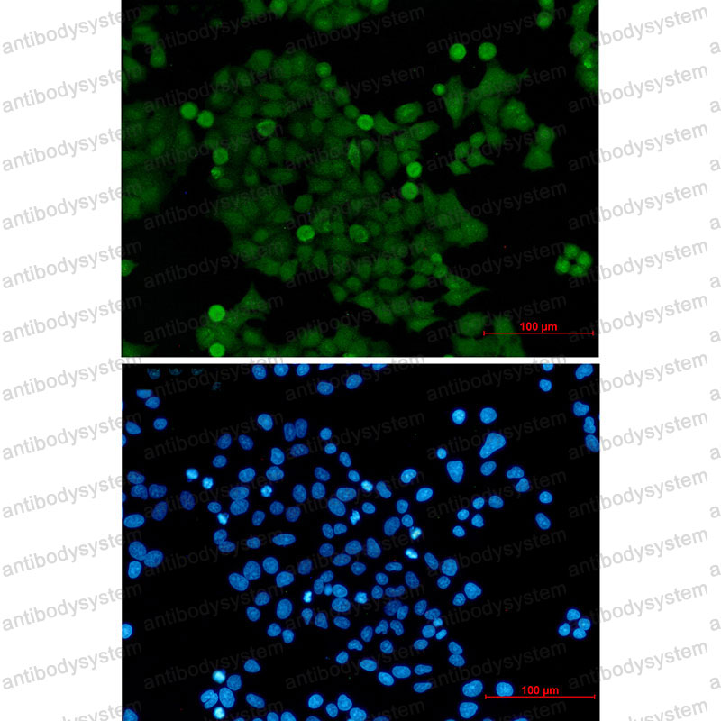Валидация IF - AntibodySystem RHN89301