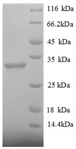 SDS-PAGE