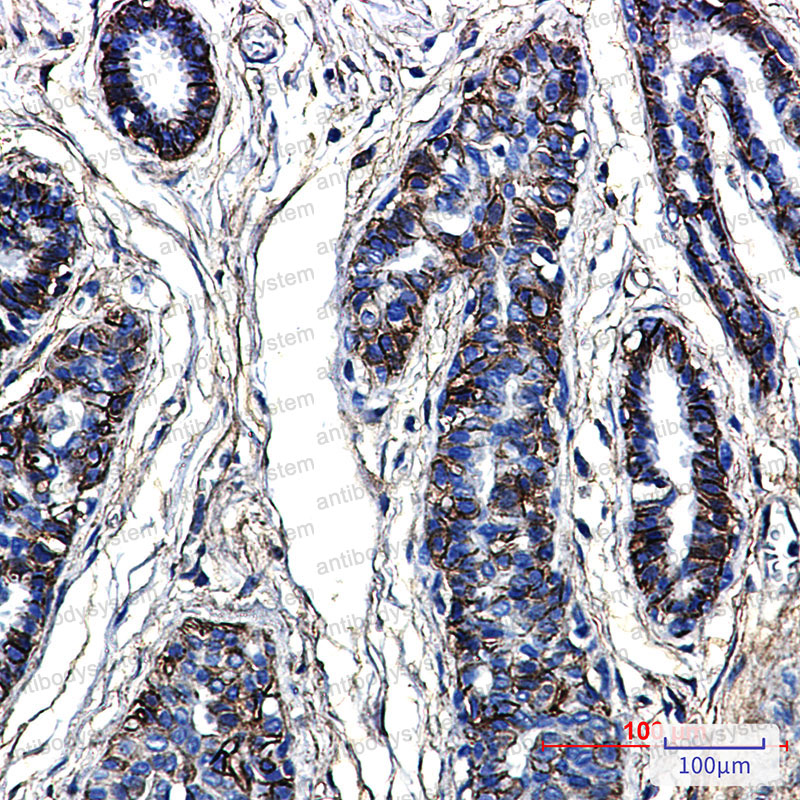 Валидация AntibodySystem RHD03603