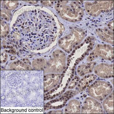Валидация AntibodySystem RHF47603