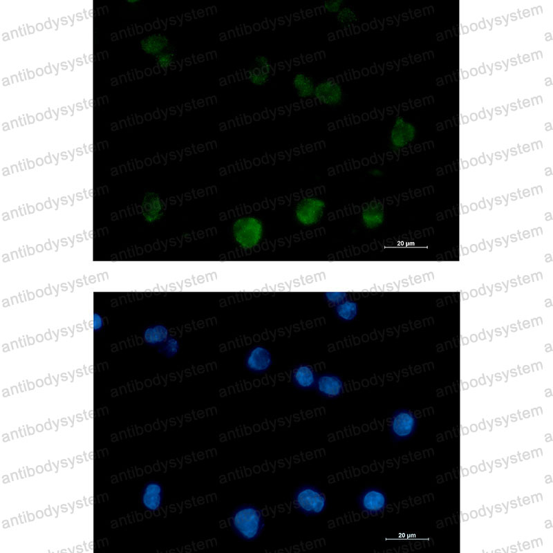 Валидация IF - AntibodySystem RHC17705
