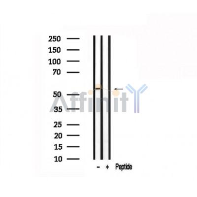Валидация Affinity AF7544 - 4203