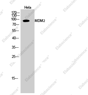 Вестерн-блоттинг, MDM2, клетки HeLa