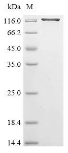 SDS-PAGE