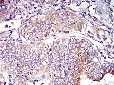 Валидация AntibodySystem RHC98602