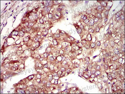 Валидация AntibodySystem RHJ56805 (3474)