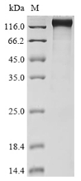 SDS-PAGE
