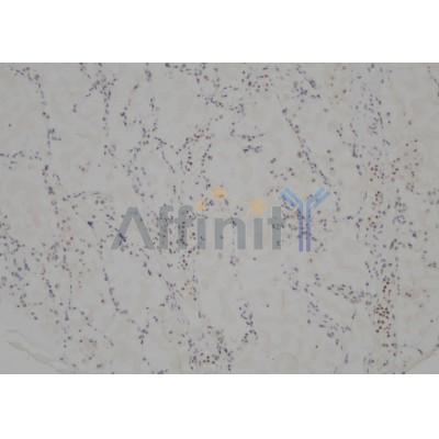 Валидация Affinity AF5280 - 2811