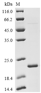 SDS-PAGE