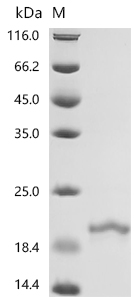 SDS-PAGE