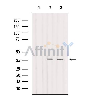 Валидация Affinity AF9140 - 4934
