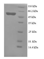 SDS-PAGE