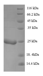 SDS-PAGE