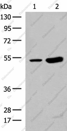 Вестерн-блоттинг, ZBTB43, ткань тимуса человека и ткань почки мыши