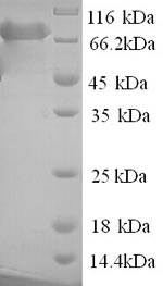 SDS-PAGE