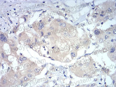 Валидация AntibodySystem RHJ52502 (3451)