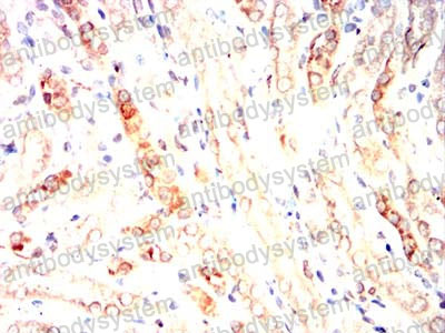 Валидация AntibodySystem RHA52803 (161)