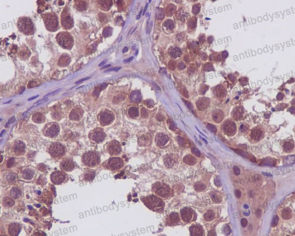 Валидация AntibodySystem RHA28502