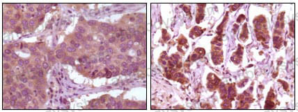 Валидация AntibodySystem RHD79502