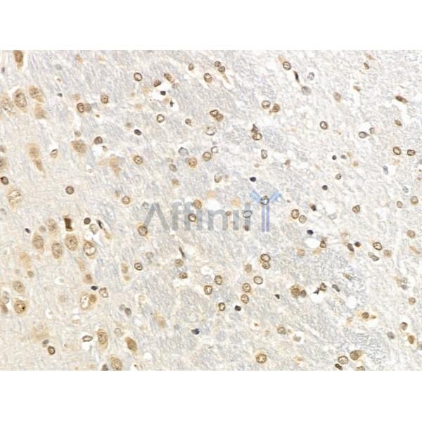 Валидация Affinity DF13627 - 9155