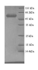 SDS-PAGE