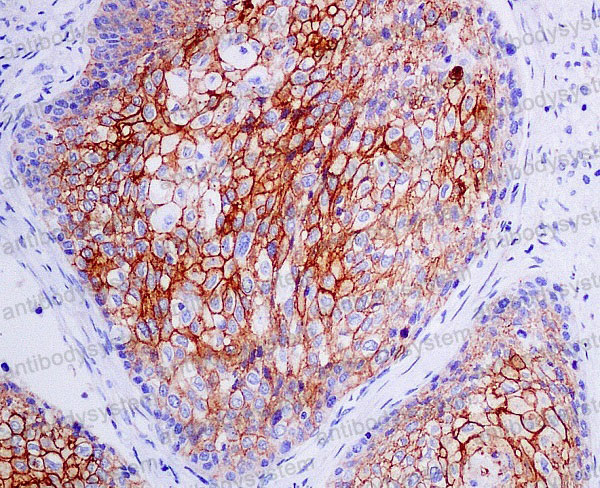 Валидация AntibodySystem RHF39902