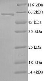 SDS-PAGE